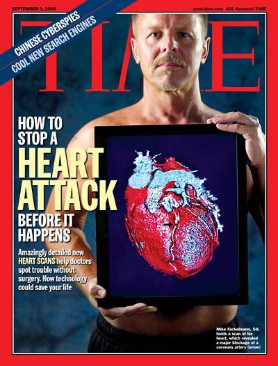 TIME cover heart scan